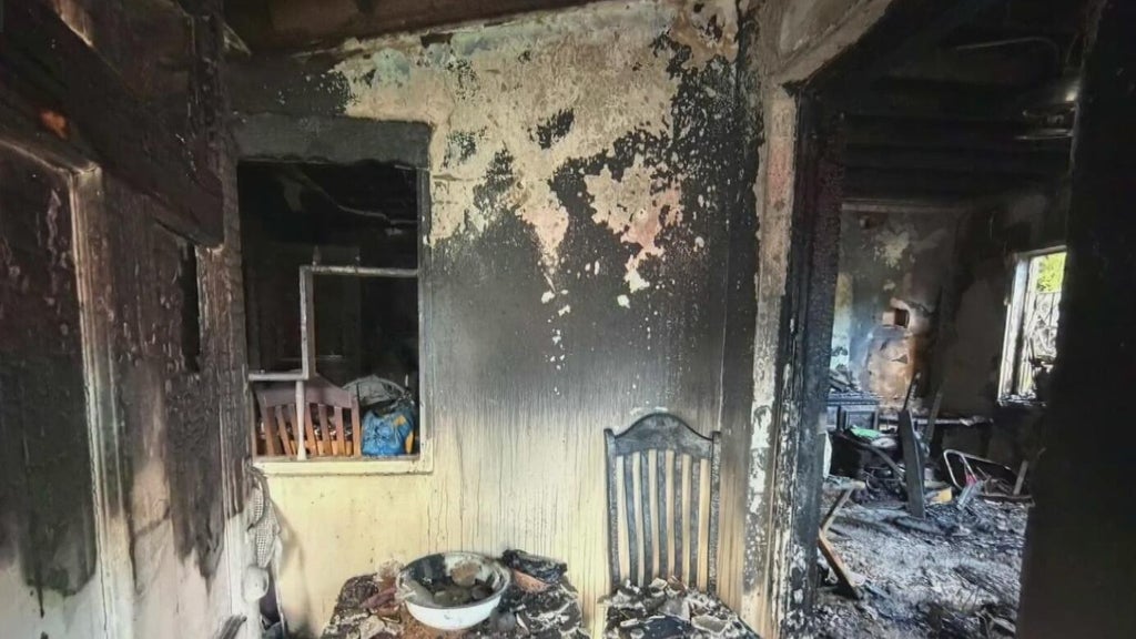 Woman hospitalized after Miami house fire leaves three displaced — CBS Miami, Sydney Health news